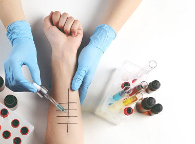 Fattori che influenzano le allergie