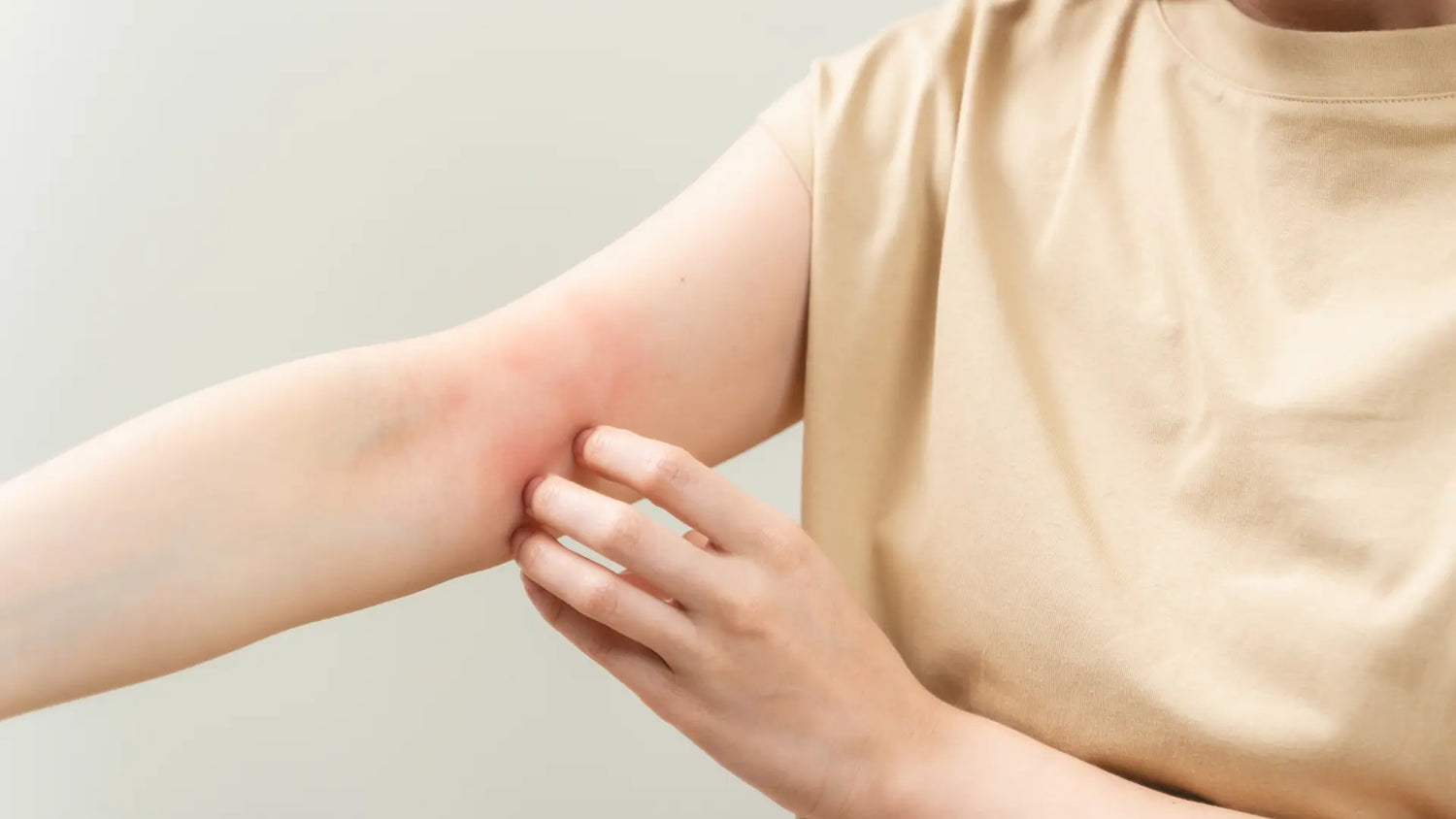 Persona che si gratta una zona arrossata del braccio, sintomo di irritazione o reazione allergica cutanea